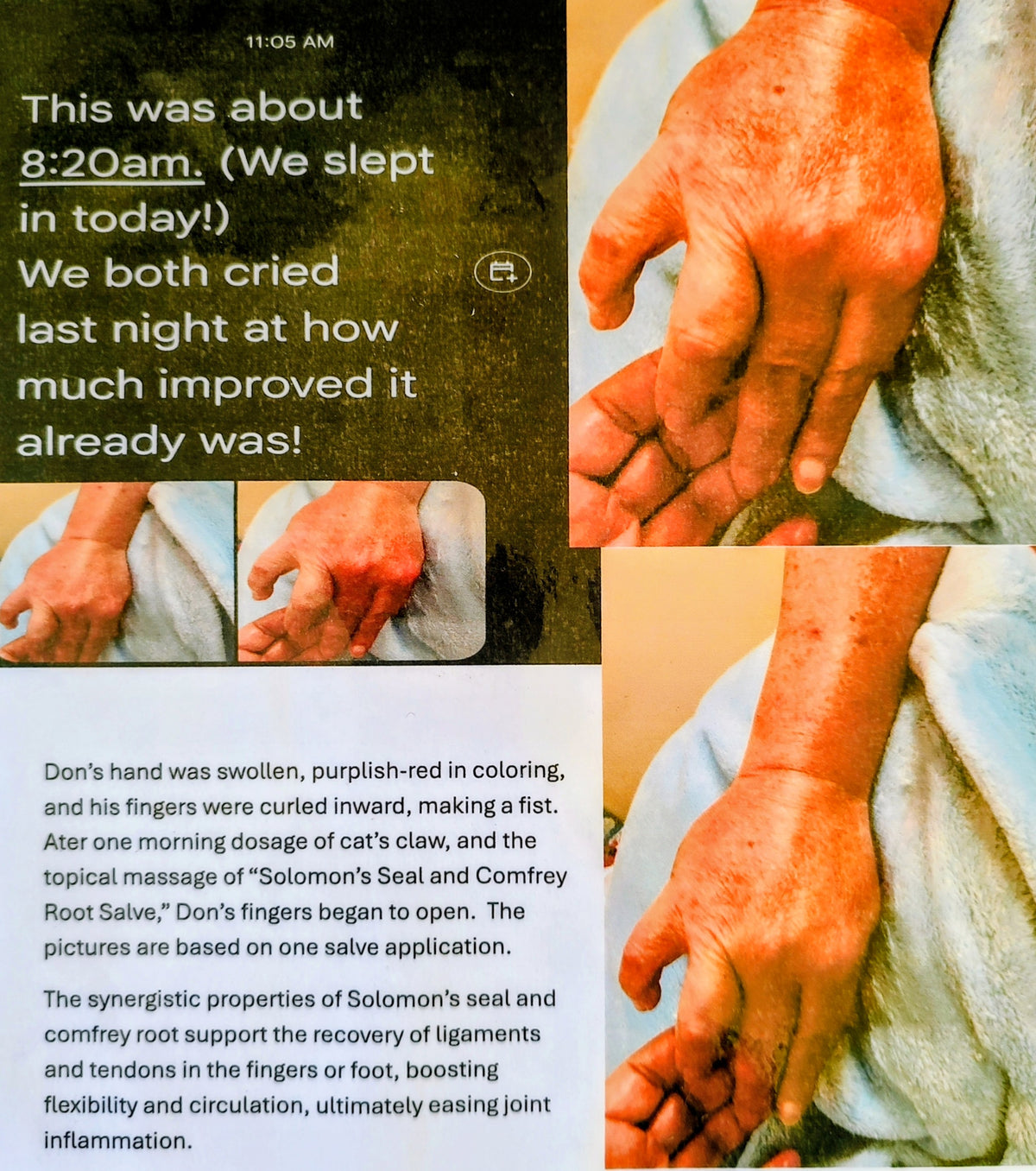 Solomon's Seal & Comfrey Salve - Ideal for Repeative Motion Injuries